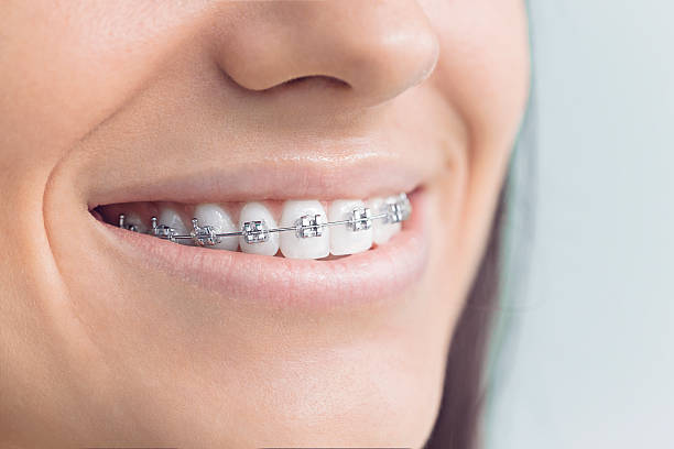 Best Teeth Whitening  in Orangeville, UT